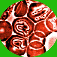 The Global Search for Education: Norway – Ticks